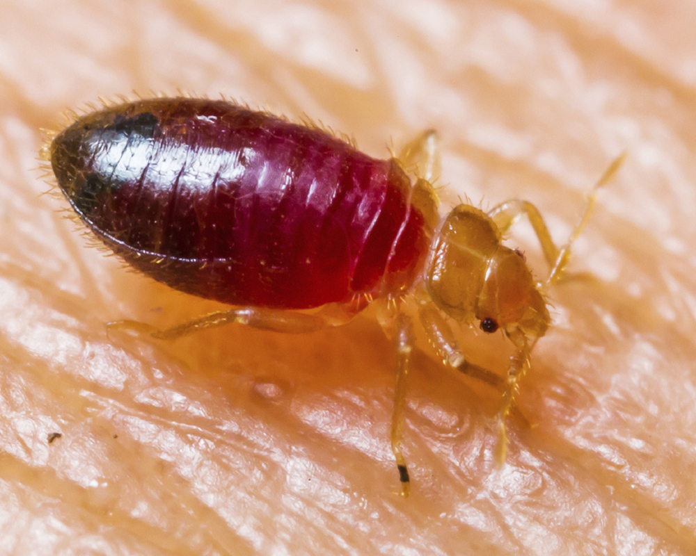 Bed Bug Bites